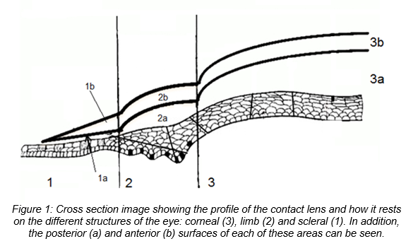 “PresbyCustom”:  New customizable contact lenses to correct presbyopia